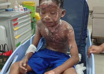TRAGEDI MERCON SPIRTUS: SEORANG ANAK TEWAS TERBAKAR, PROF. SUTAN NASOMAL DESAK APH LAKUKAN RAZIA NASIONAL