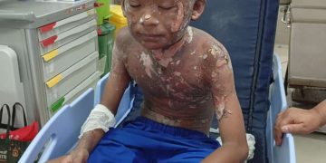 TRAGEDI MERCON SPIRTUS: SEORANG ANAK TEWAS TERBAKAR, PROF. SUTAN NASOMAL DESAK APH LAKUKAN RAZIA NASIONAL