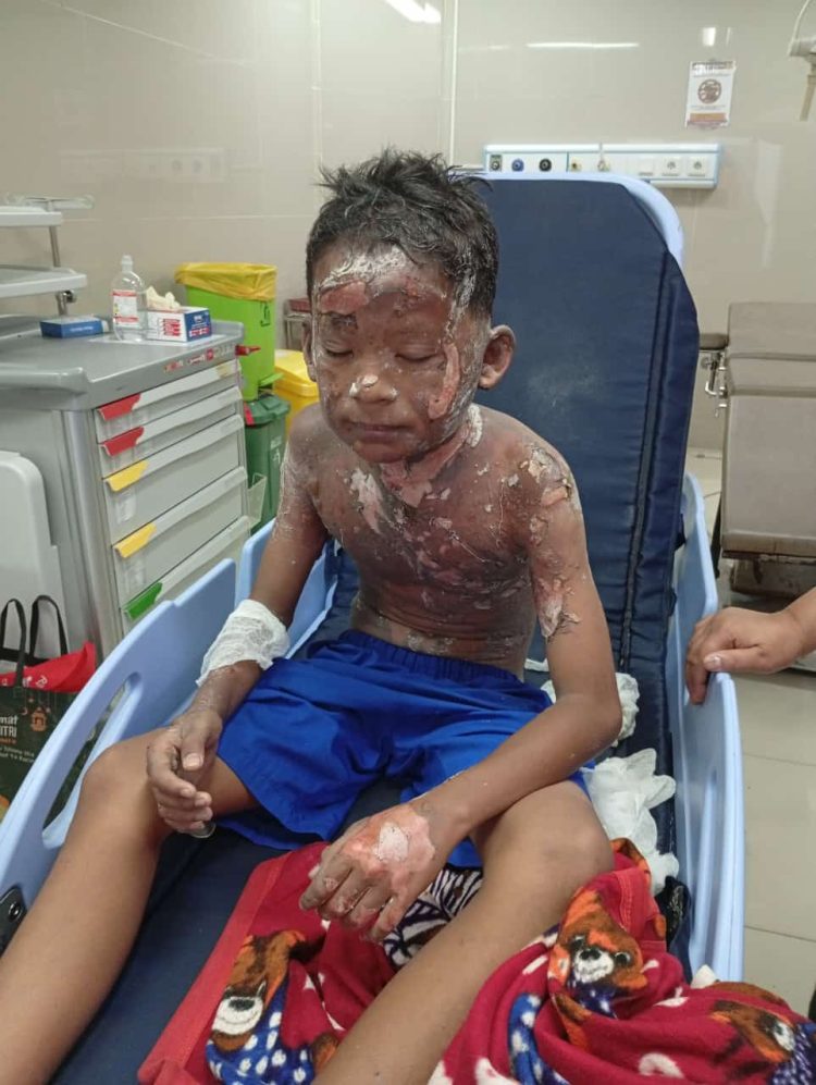 TRAGEDI MERCON SPIRTUS: SEORANG ANAK TEWAS TERBAKAR, PROF. SUTAN NASOMAL DESAK APH LAKUKAN RAZIA NASIONAL