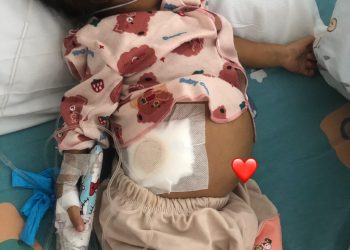 Butuh Uluran Tangan Orang Baik: Selamatkan Adik Zoeya yang Berjuang Melawan Penyakit Hati Langka