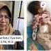 Hj. Syarifatul Sya’diah, S.Pd.,M.Si. Peduli Sesama, Ulurkan Bantuan untuk Ananda Zoeya yang Berjuang Menuju Transplantasi Hati di RSCM