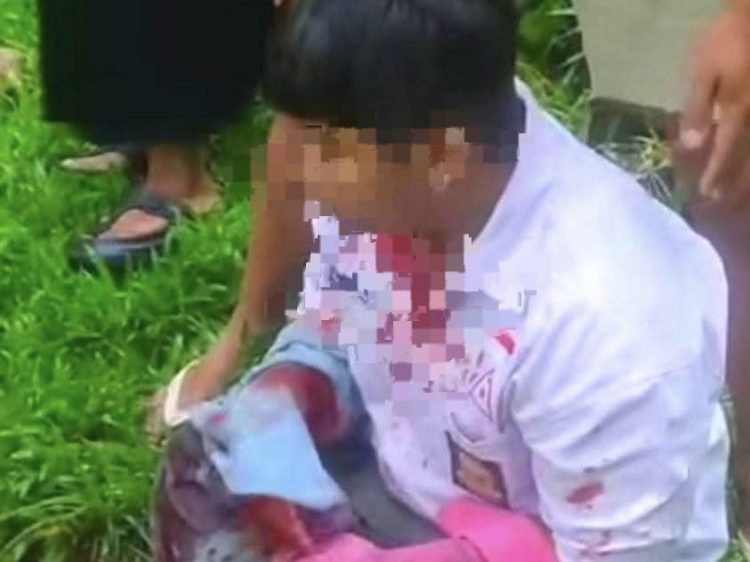 Kapolres Binjai Bentuk Tim Khusus Anti Begal Usai Pelajar SMA Dibacok